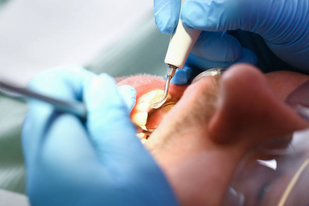 Best Emergency Root Canal Treatment in South Toms River, NJ